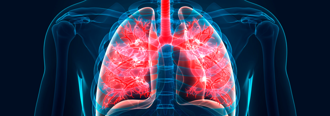 Bronquitis: 6 de sus principales causas.